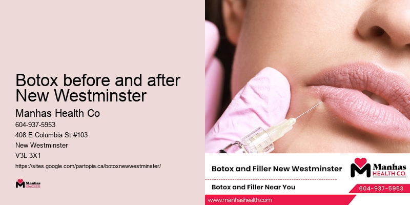 Botox before and after New Westminster