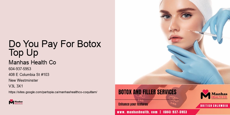 Do You Pay For Botox Top Up
