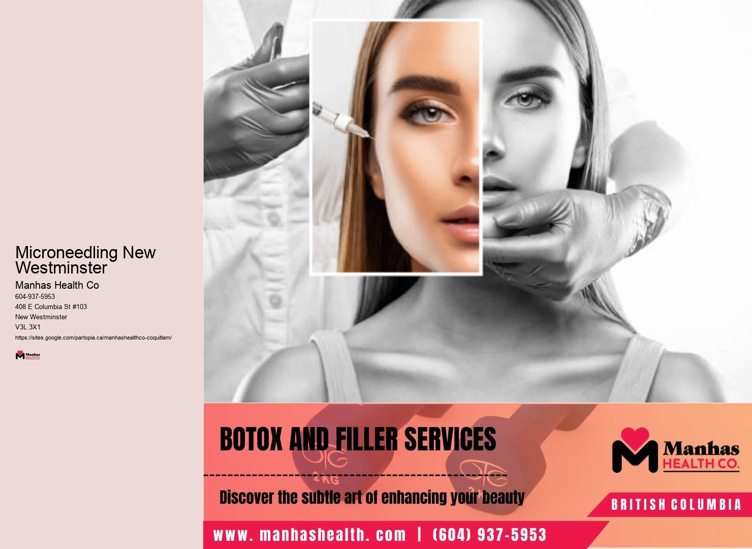 Botox clinic near me New Westminster