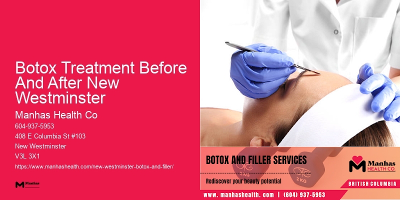 Botox side effects Botox Treatment Before And After New Westminster