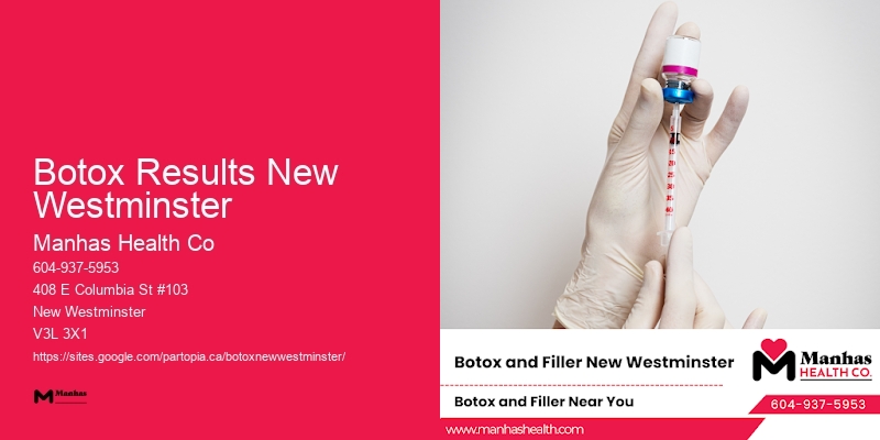 Botox effects Botox Results New Westminster