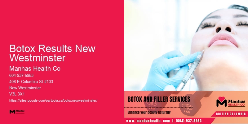 Botox for a smoother jawline Botox Results New Westminster