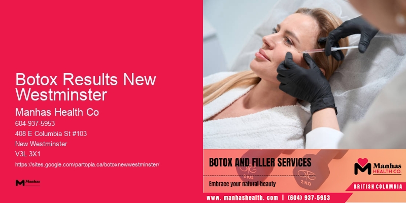 Botox beauty services Botox Results New Westminster