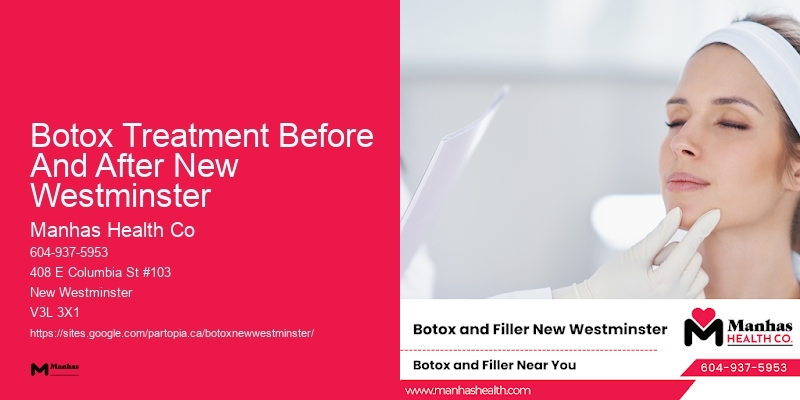 Botox Treatment Before And After New Westminster
