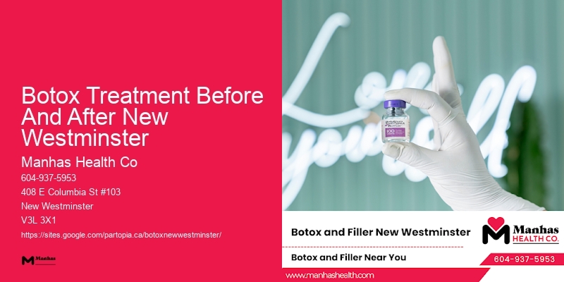 Botox for men Botox Treatment Before And After New Westminster