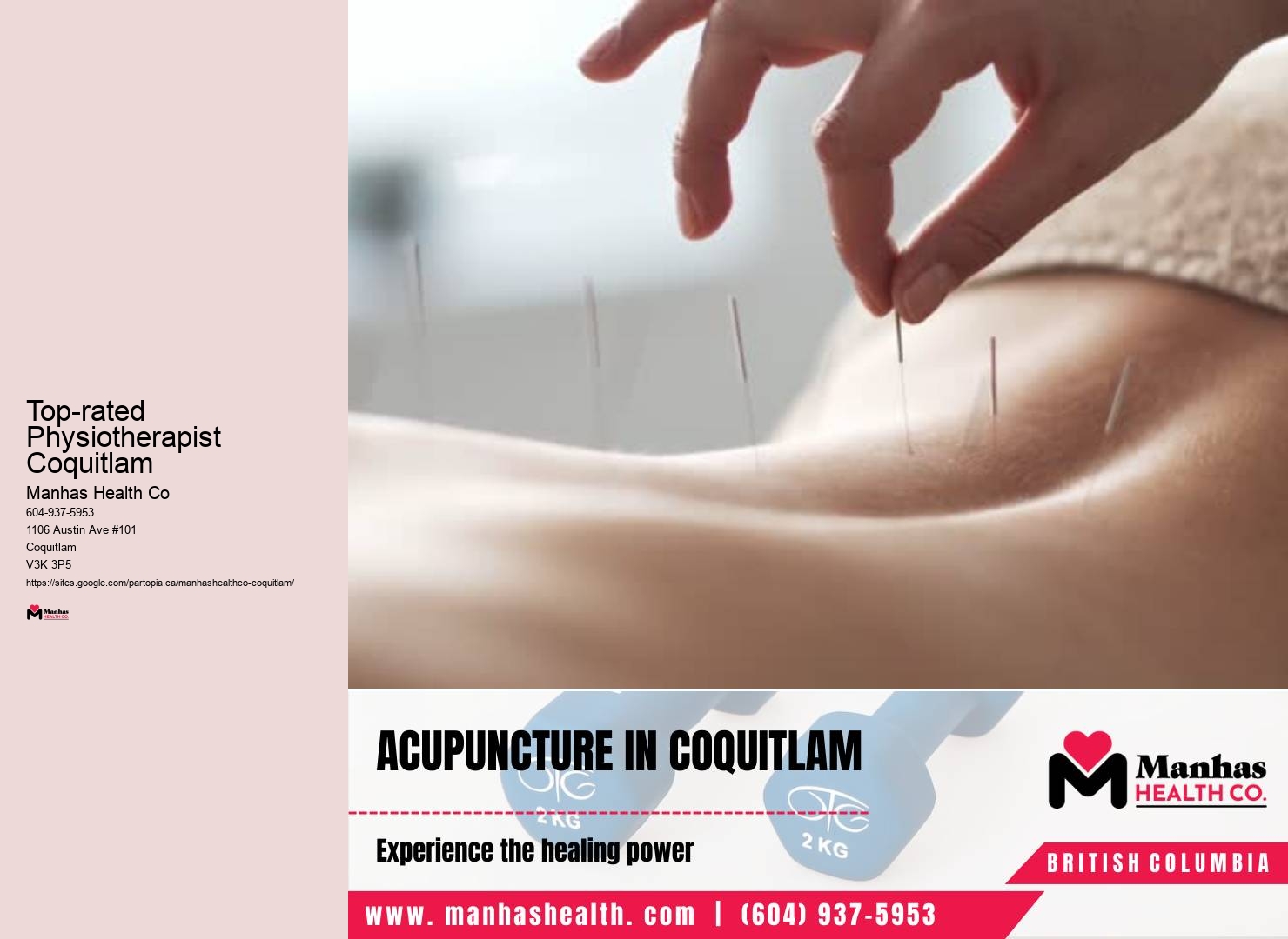 Affordable Physiotherapist Top-rated Physiotherapist Coquitlam